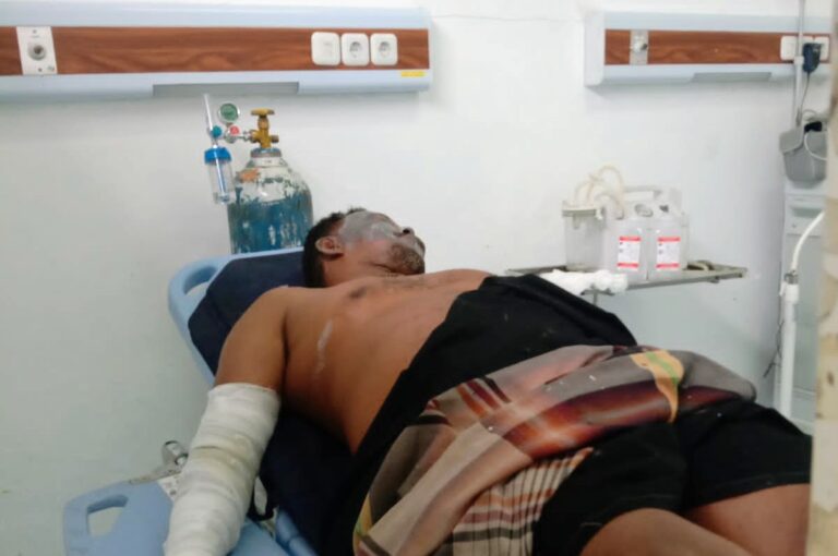 BREAKING NEWS: Tempat Penampungan Minyak Terbakar di Ranto Peureulak, 3 Orang Alami Luka Bakar Juli 22, 2022