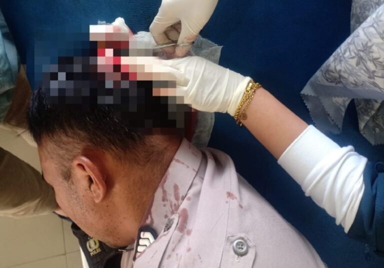 Hendak Amankan ODGJ, Dua Polisi di Bener Meriah Terluka Kena Senjata Tajam November 17, 2022