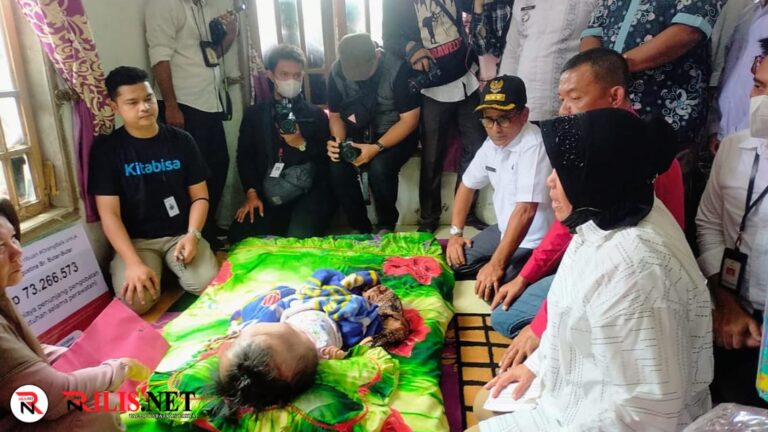 Kunjungi Aceh Timur, Menteri Sosial Bangun RLH dan Bantu Pengobatan Anak Penderita Hidrosefalus Februari 1, 2023